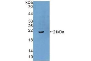 Detection of Recombinant XPo1, Human using Polyclonal Antibody to Exportin 1 (XPO1) (XPO1 antibody  (AA 917-1071))