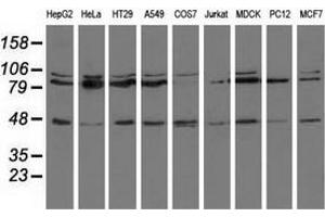 Western blot analysis of extracts (35 µg) from 9 different cell lines by using anti-CD80 monoclonal antibody. (CD80 antibody)