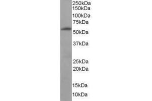FTCD anticorps  (Internal Region)