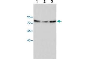 Western blot analysis of 293 (Lane 1), human fetal liver (Lane 2) and HepG2 (Lane 3) lysate with ANXA6 polyclonal antibody  at 1:500 dilution. (ANXA6 antibody)
