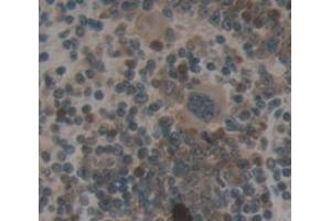 IHC-P analysis of Mouse Tissue, with DAB staining. (TRADD antibody  (AA 21-259))