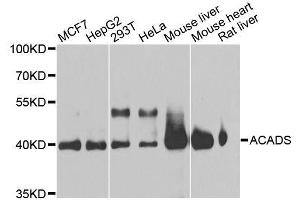 Western blot analysis of extracts of various cell lines, using ACADS antibody. (ACADS antibody  (AA 1-260))
