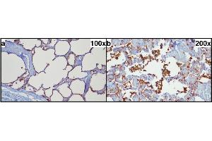 Typical pulmonal findings in SP-A (surfactant protein A) immunohistochemistry. (Surfactant Protein A1 antibody  (Internal Region))