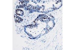 Immunohistochemistry (IHC) image for anti-SWI/SNF Related, Matrix Associated, Actin Dependent Regulator of Chromatin, Subfamily E, Member 1 (SMARCE1) antibody (ABIN7308352) (SMARCE1 antibody)