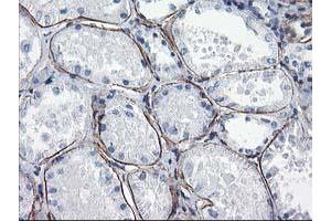 Immunohistochemical staining of paraffin-embedded Human Kidney tissue using anti-LDLRAP1 mouse monoclonal antibody.