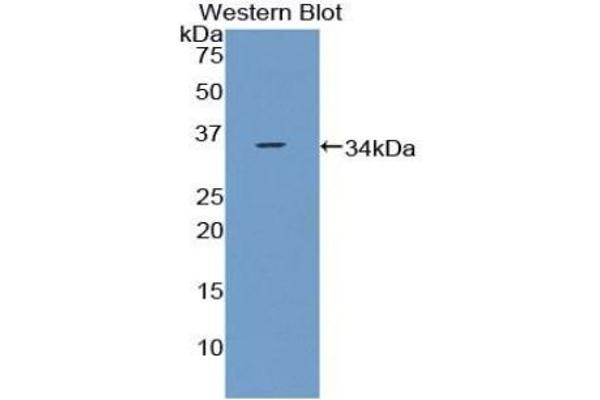CCDC80 Antikörper  (AA 635-906)