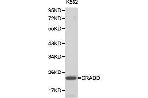 Western blot analysis of K562 cell lysate using CRADD antibody. (CRADD antibody  (AA 1-199))