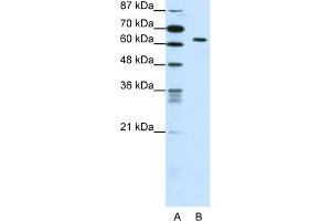 WB Suggested Anti-SMAD1 Antibody Titration:  0. (SMAD1 antibody  (C-Term))