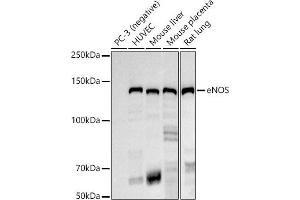 Western blot analysis of extracts of various cell lines, using eNOS antibody (ABIN7268920) at 1:1000 dilution. (ENOS antibody)