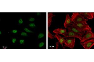 ICC/IF Image NRF2 antibody [N2C2], Internal detects NRF2 protein at nucleus by immunofluorescent analysis. (NRF2 antibody  (Internal Region))