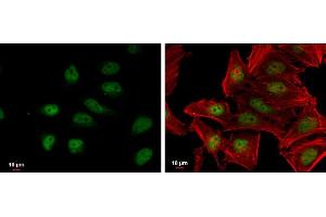 ICC/IF Image NRF2 antibody [N2C2], Internal detects NRF2 protein at nucleus by immunofluorescent analysis.