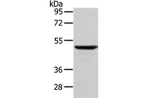 Western Blotting (WB) image for anti-WAS Protein Family, Member 2 (WASF2) antibody (ABIN5957856) (WASF2 antibody)
