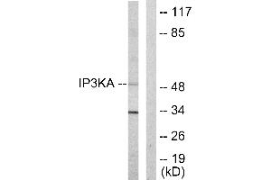 Western blot analysis of extracts from HUVEC cells, using IP3KA antibody. (ITPKA antibody  (C-Term))