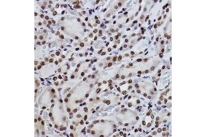 Immunohistochemistry of paraffin-embedded rat kidney using Acetyl-Histone H3-K27 Rabbit mAb (ABIN3016650, ABIN3016651, ABIN3016652, ABIN1682513 and ABIN1682514) at dilution of 1:100 (40x lens). (Histone 3 antibody  (acLys27))