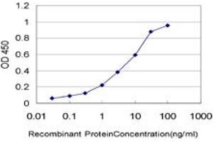 Detection limit for recombinant GST tagged STK17A is approximately 0. (STK17A antibody  (AA 301-413))