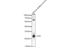 Western blot analysis of extracts of Mouse skeletal muscle, using C antibody (ABIN6131265, ABIN6137793, ABIN6137794 and ABIN6217485) at 1:1000 dilution. (CA3 antibody  (AA 1-260))