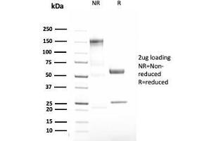 SDS-PAGE Analysis Purified Alpha-1-Antitrypsin Recombinant Rabbit Monoclonal (AAT/3167R). (Recombinant SERPINA1 antibody)