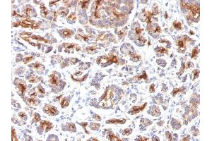 Formalin-fixed, paraffin-embedded human Pancreas stained with CFTR Monoclonal Antibody (SPM176). (CFTR antibody)