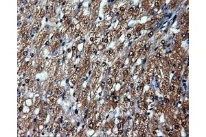 Immunohistochemical staining of paraffin-embedded prostate tissue using anti-HSP90AA1mouse monoclonal antibody.