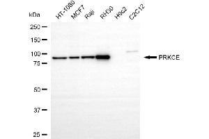 Western blotting analysis using PRKCE antibody (ABIN7799996).