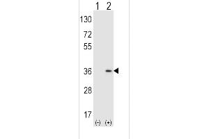 Western blot analysis of SULT1A1 using rabbit polyclonal SULT1A1 Antibody (Y143) using 293 cell lysates (2 ug/lane) either nontransfected (Lane 1) or transiently transfected (Lane 2) with the SULT1A1 gene. (SULT1A1 antibody  (AA 128-160))