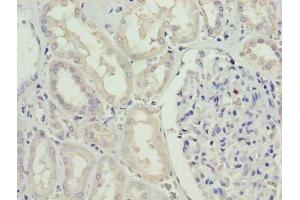 Immunohistochemistry of paraffin-embedded human kidney tissue using ABIN7168881 at dilution of 1:100 (SDSL antibody  (AA 39-169))