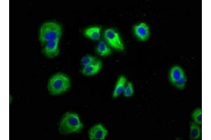 Immunofluorescence staining of HepG2 cells with ABIN7145127 at 1:166, counter-stained with DAPI. (AXIN2 antibody  (AA 11-77))