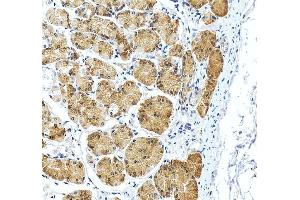 IHC analysis of RPS2 using anti-RPS2 antibody (ABIN7601997). (RPS2 antibody  (AA 54-293))