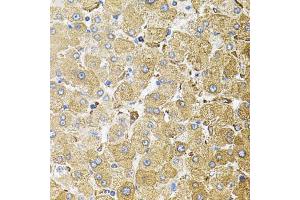 Immunohistochemistry of paraffin-embedded human liver injury using CEP164 antibody (ABIN6003672) (40x lens).