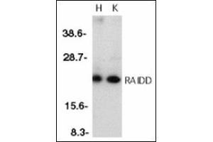 Western blot analysis of RAIDD in whole cell lysates from HeLa (H) or K562 (K) cells with RAIDD antibody at 1 µg/ml