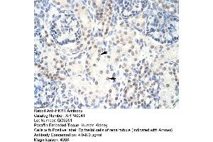 Human kidney (HKR1 antibody  (C-Term))