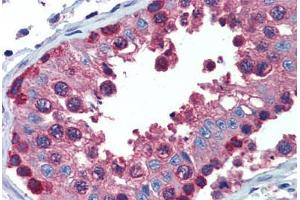 Testis, Human: Formalin-Fixed, Paraffin-Embedded (FFPE) (PDIA4 antibody  (AA 623-638))