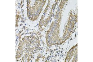 Immunohistochemistry of paraffin-embedded human stomach using FLNB antibody (ABIN5971317) at dilution of 1/100 (40x lens).