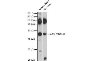 Immunofluorescence analysis of U2OS cells using ATGL/PNPL antibody (ABIN6132218, ABIN6145857, ABIN6145858 and ABIN6221844) at dilution of 1:100. (PNPLA2 antibody  (AA 265-504))