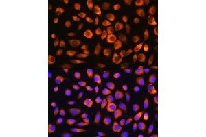 Immunofluorescence analysis of L929 cells using Hsc70/HSP Rabbit pAb (ABIN3016123, ABIN3016124, ABIN3016125 and ABIN6219558) at dilution of 1:100. (Hsc70 antibody  (AA 1-300))