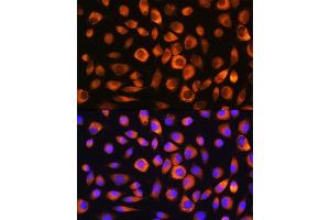 Immunofluorescence analysis of L929 cells using Hsc70/HSP Rabbit pAb (ABIN3016123, ABIN3016124, ABIN3016125 and ABIN6219558) at dilution of 1:100. (Hsc70 antibody  (AA 1-300))