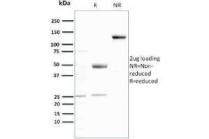 SDS-PAGE Analysis Purified Ubiquitin Recombinant Rabbit Monoclonal Antibody (UBB/3143R).