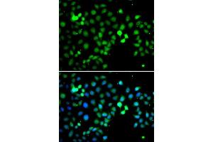 Immunofluorescence analysis of A549 cells using MTF2 antibody. (MTF2 antibody  (AA 1-190))