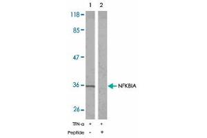 Western blot analysis of extracts from 293 cells using NFKBIA polyclonal antibody . (NFKBIA antibody)
