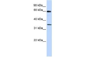 Western Blotting (WB) image for anti-General Transcription Factor IIB (GTF2B) antibody (ABIN2460003) (GTF2B antibody)