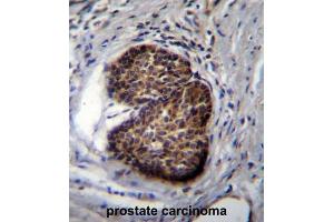 Immunohistochemistry (IHC) image for anti-Prostate Stem Cell Antigen (PSCA) antibody (ABIN2997805) (PSCA antibody)