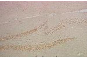 Immunohistochemistry of paraffin-embedded Mouse hippocampus tissue using NFκB-p65 Monoclonal Antibody at dilution of 1:200. (NF-kB p65 antibody)