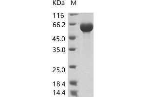 AcMNPV-GP64 protein (His tag)