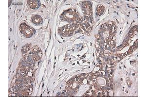 Immunohistochemical staining of paraffin-embedded breast using anti-CPA1 (ABIN2452647) mouse monoclonal antibody.