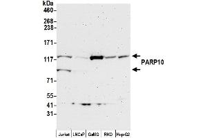 Western Blotting (WB) image for anti-Poly (ADP-Ribose) Polymerase Family, Member 10 (PARP10) (AA 300-350) antibody (ABIN7454656)