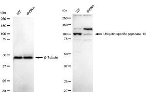 Western blotting analysis using Ubiquitin specific peptidase 13 antibody (ABIN7800726). (Recombinant USP13 antibody)