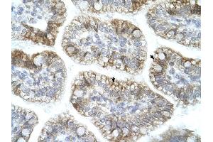 APBA1 antibody was used for immunohistochemistry at a concentration of 4-8 ug/ml to stain Epithelial cells of intestinal villus (arrows) in Human Intestine.
