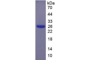 SDS-PAGE (SDS) image for Interleukin-27 subunit beta (IL-27b) (AA 21-229) protein (His tag) (ABIN1079428)
