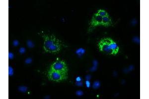 Image no. 3 for anti-Spastic Paraplegia 7 (SPG7) (AA 300-573) antibody (ABIN1491370) (SPG7 antibody  (AA 300-573))