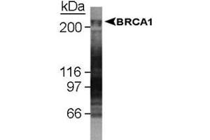 Western blot analysis of BRCA1 in U-2 OS whole cell lysate using BRCA1 monoclonal antibody, clone KEN . (BRCA1 antibody  (AA 1314-1864))